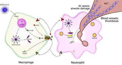 COVID-19: Lung-Centric Immunothrombosis